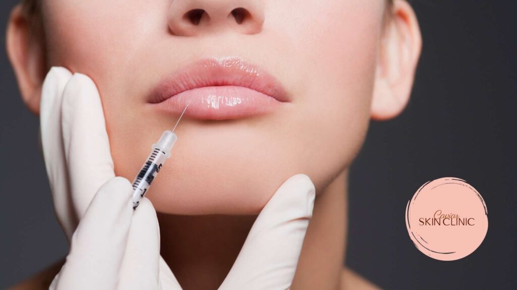 3 Things to Know About Botox Injections