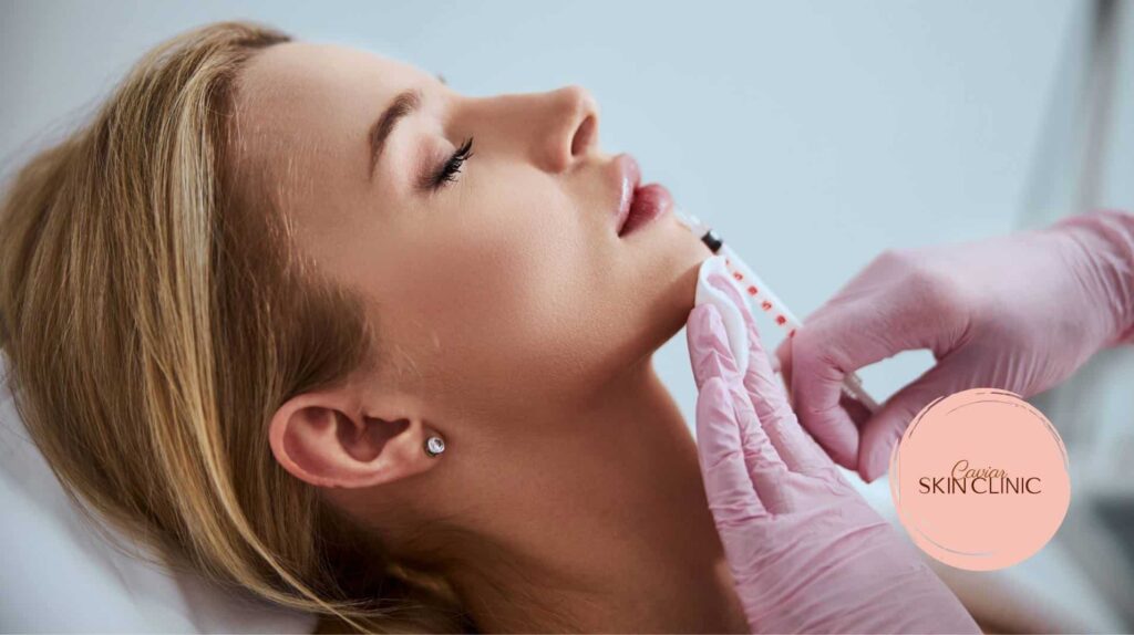 Dermal fillers in Vancouver