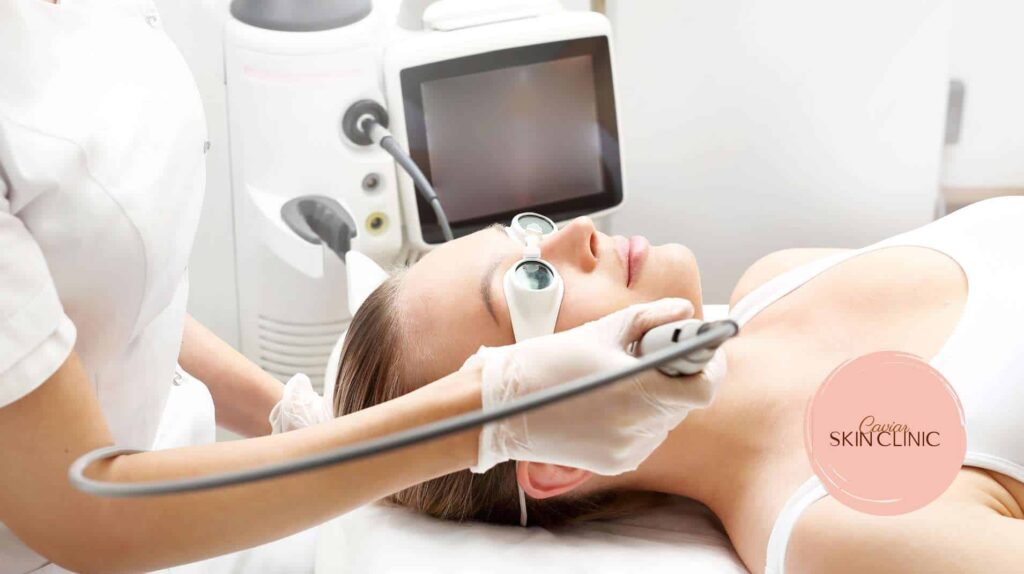 Laser Skin Rejuvenation in Vancouver
