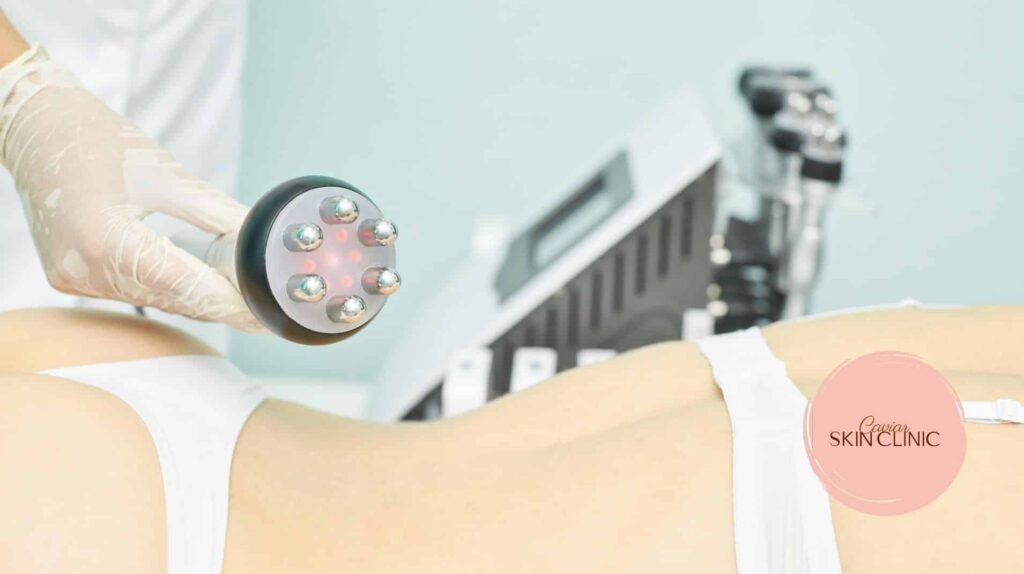 aser skin tightening treatments in Vancouver